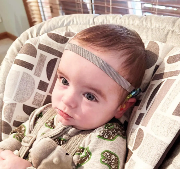 A baby wearing a hearing aid headband is sitting in a high chair, looking at the camera with a neutral expression.